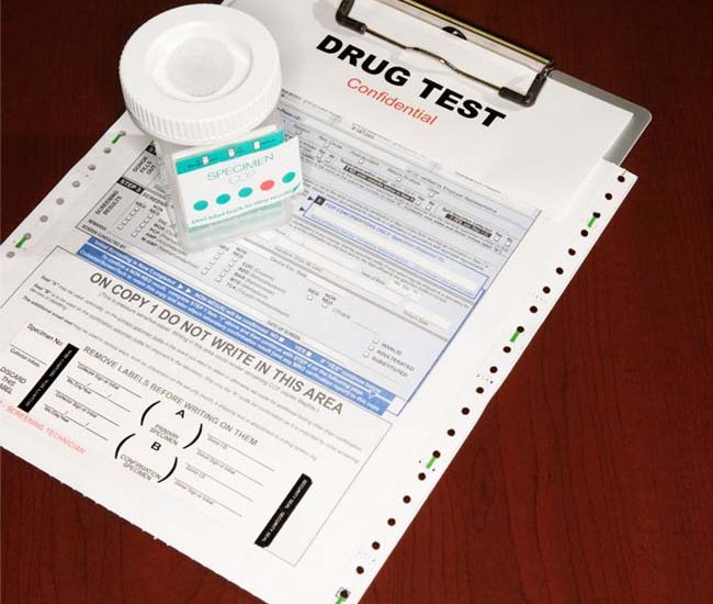 LabCorp Drug Test (Urine) Results