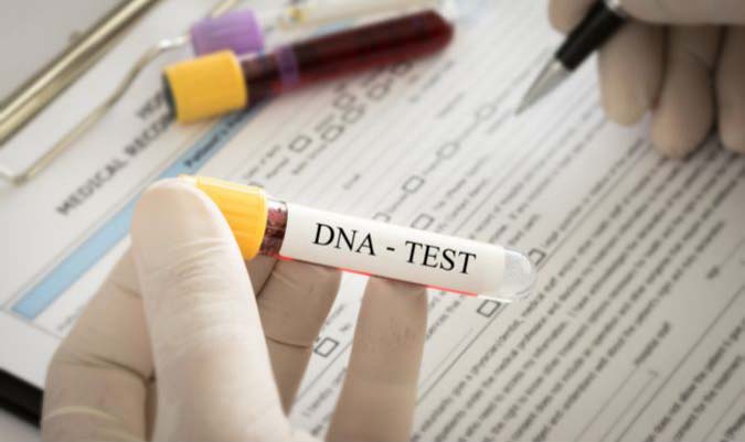 Read Labcorp DNA Test