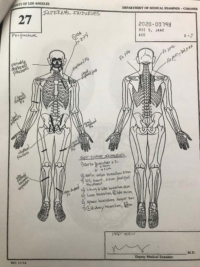 Gigi’s Autopsy Sketch (Report) 2