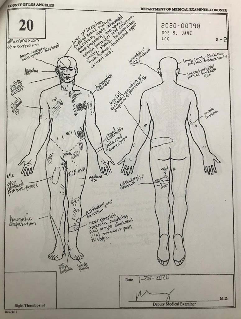 Gigi’s Autopsy Sketch (Report)